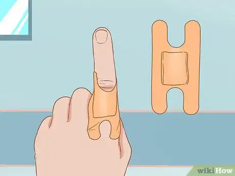 Image titled Apply Different Types of Bandages Step 18