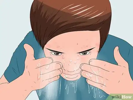 Image titled Deal With Acne when You Have Sensitive Skin Step 4