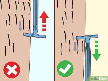 Image titled Remove an Ingrown Hair Step 10