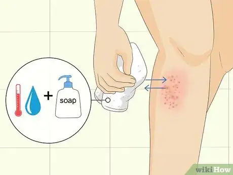 Image titled Soothe Itchy Legs Step 24