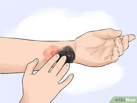 Image titled Gain Potential Health Benefits from Activated Charcoal Step 8