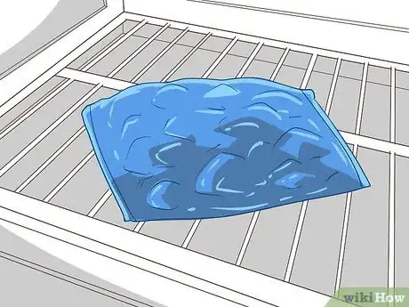 Image titled Cope with Psoriasis at Work Step 3