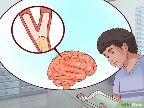 Image titled Identify Stroke Symptoms As a Young Adult Step 13