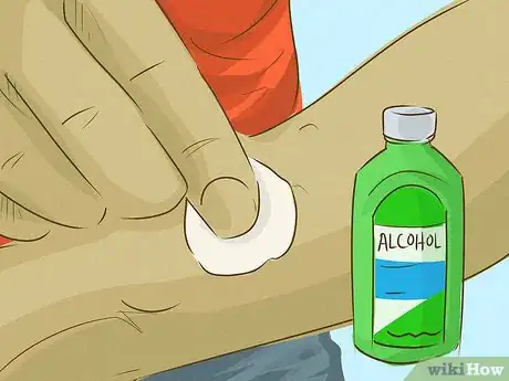 Image titled Stop Scratching a Mosquito Bite Step 16