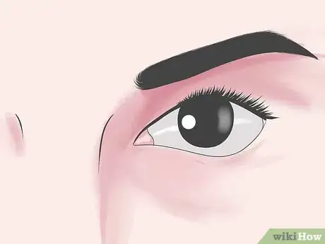 Image titled Prevent Macular Degeneration Step 1