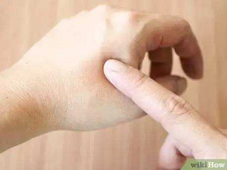 Image titled Use Jojoba Oil for Acne Step 8