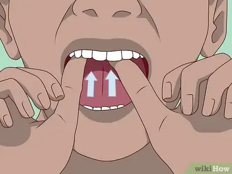 Image titled Replace a Tooth Step 4