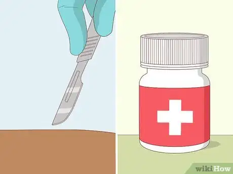 Image titled Detect Chromosomal Abnormalities Step 8