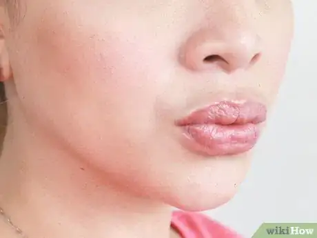 Image titled Get Plump Juicy Lips Without Makeup Step 8