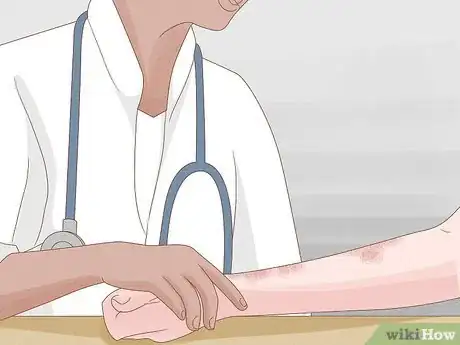 Image titled Garden if You Have Seasonal Allergies Step 7