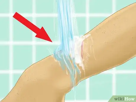 Image titled Heal a Cut Due to Dry Skin Step 1