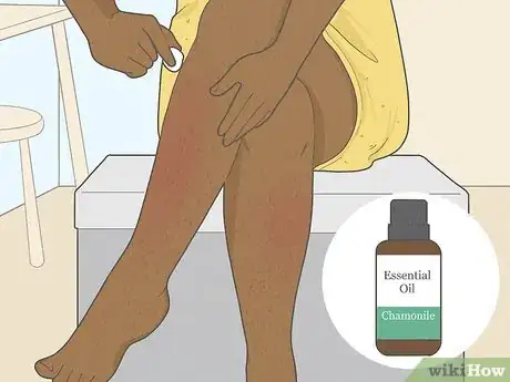 Image titled Get Rid of Razor Burn Fast Step 9