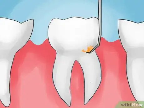 Image titled Avoid Gum Disease Problems Step 09