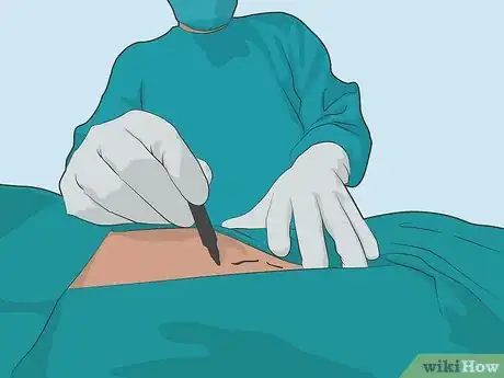 Image titled Treat a Strained Hamstring Step 04