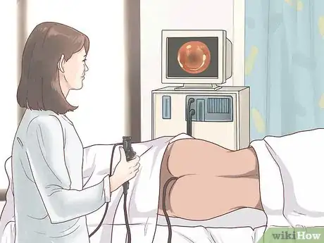 Image titled Treat Colon Cancer Step 9