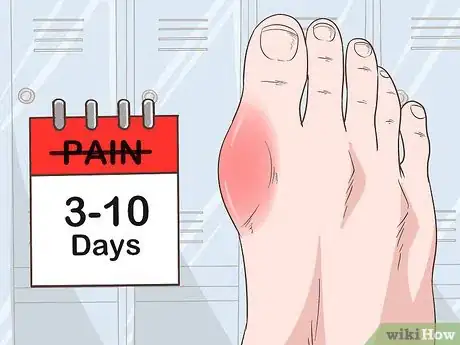 Image titled Identify Hyperuricemia Step 6