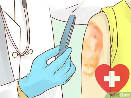 Image titled Prevent Dry Scalp Step 18