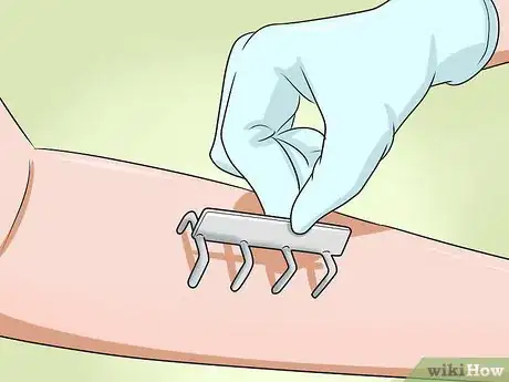 Image titled Cure Post Nasal Drip Step 3