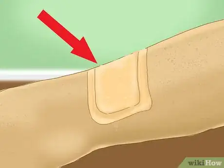 Image titled Heal a Cut Due to Dry Skin Step 3