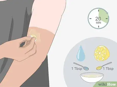 Image titled Get Fair Skin Naturally Step 9