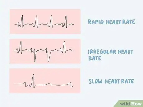 Image titled Test Your Thyroid at Home Step 5