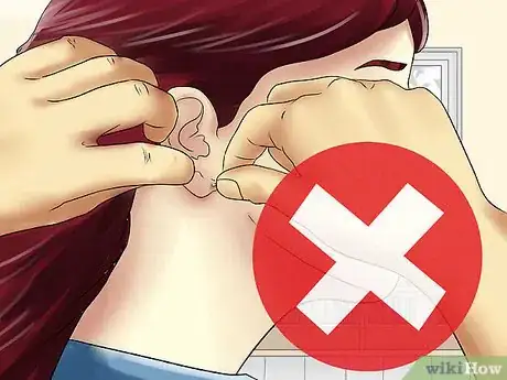 Image titled Care for an Auricle Piercing Step 9