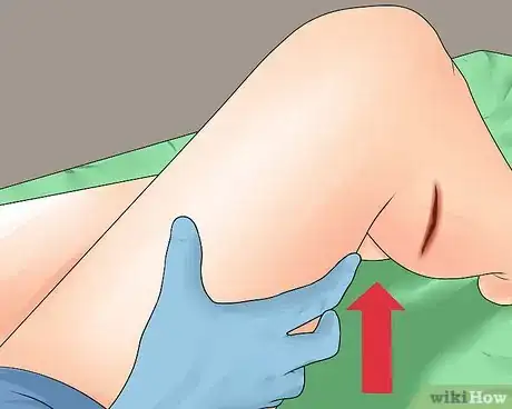 Image titled Stop Mild Bleeding During First Aid Step 4