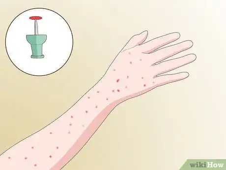 Image titled Detect Whiplash Step 7