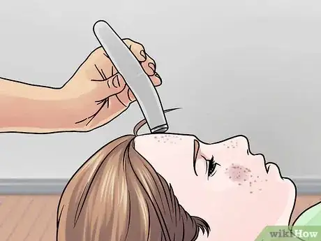 Image titled Get Rid of Cystic Acne Scars Step 8