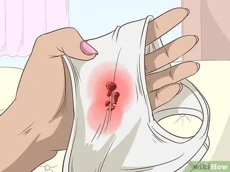 Image titled Know the Symptoms of Ovarian Cancer Step 4