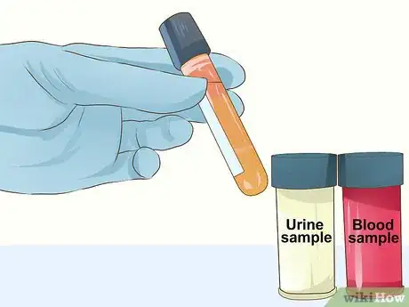 Image titled Diagnose Behavioral Dysfunction in Senior Dogs Step 9