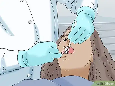 Image titled Clean Wisdom Teeth Step 8
