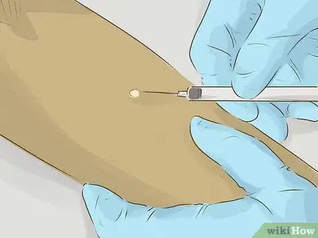 Image titled Test for Tuberculosis Step 2