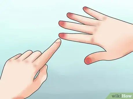 Image titled Prevent Frostbite Step 21