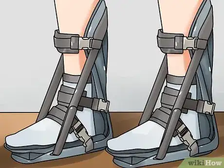 Image titled Recognize Plantar Fasciitis Symptoms Step 19