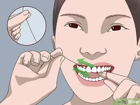 Image titled Prevent Your Teeth from Falling Out Step 1