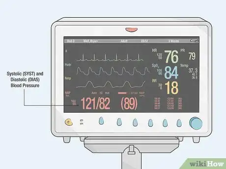 Image titled Read an ICU Monitor Step 5