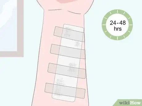 Image titled Prevent Surgical Site Infections Step 8