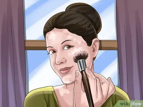Image titled Diagnose Vitiligo Step 10