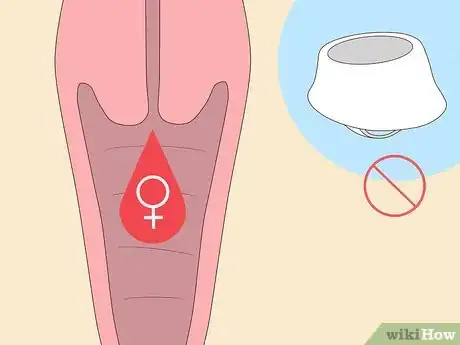 Image titled Use a Cervical Cap Step 11