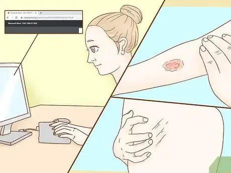 Image titled Get a Sleep Study Step 1