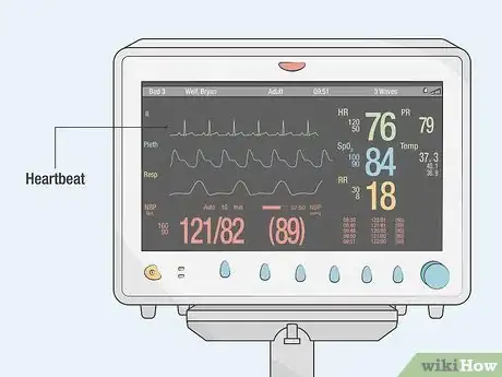 Image titled Read an ICU Monitor Step 6