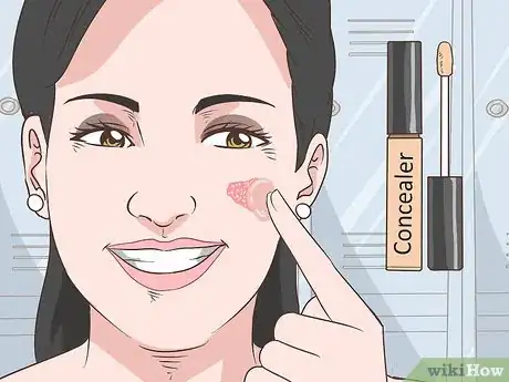 Image titled Cope with Psoriasis at Work Step 6