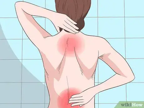 Image titled Know the Symptoms of Ovarian Cancer Step 5