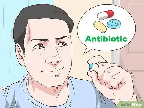 Image titled Treat NGU Step 5