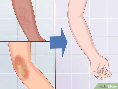 Image titled Benefit from Red Light Therapy Step 3