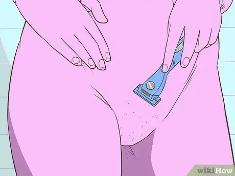 Image titled Prepare for a Vaginoplasty Step 28