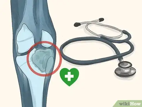 Image titled Treat Macrocytic Anemia Step 21