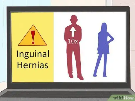 Image titled Treat Inguinal Hernia Step 2