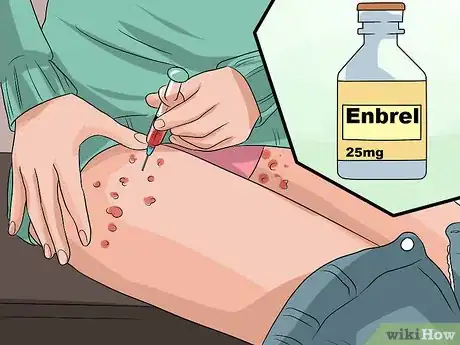 Image titled Avoid Psoriasis Vaccine Complications Step 8